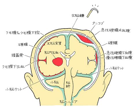 頭上